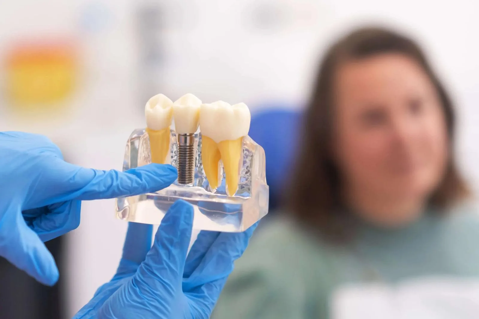 Restore Your Smile with Dental Implants and Restorations after photo